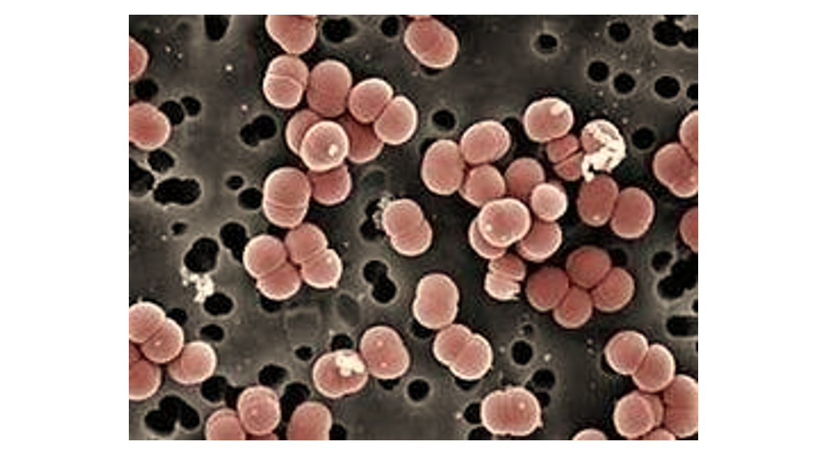 Enterococcus Faecalis Vs Faecium