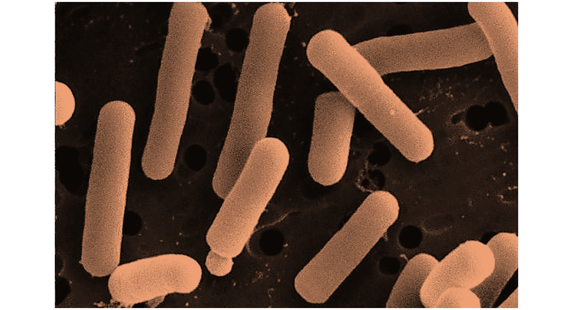 Палочка бифидобактерии. Lactobacillus reuteri под микроскопом. Lactobacillus helveticus (швейцарская палочка).. Ацидофильные лактобактерии (Lactobacillus Acidophilus). Инактивированные бактерии пробиотического штамма Lactobacillus reuteri.