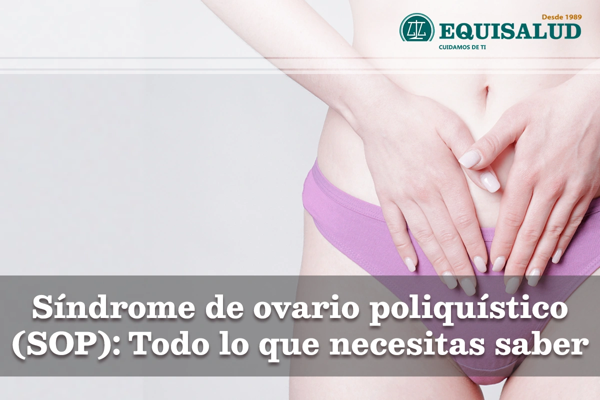 Síndrome de ovario poliquístico (SOP) - Todo lo que necesitas saber